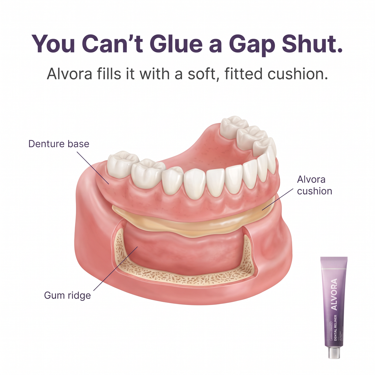 Diagram: Alvora cushion fills the gap between gum ridge and denture base